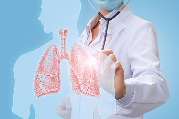 기침, 누런 가래 지속…치료 늦어지면 위험한 폐렴